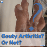 Gouty Arthritis Or Not photo